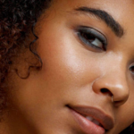 Targeted Treatments for Black Skin Acne