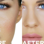 Oily Face Skin Care Routine
